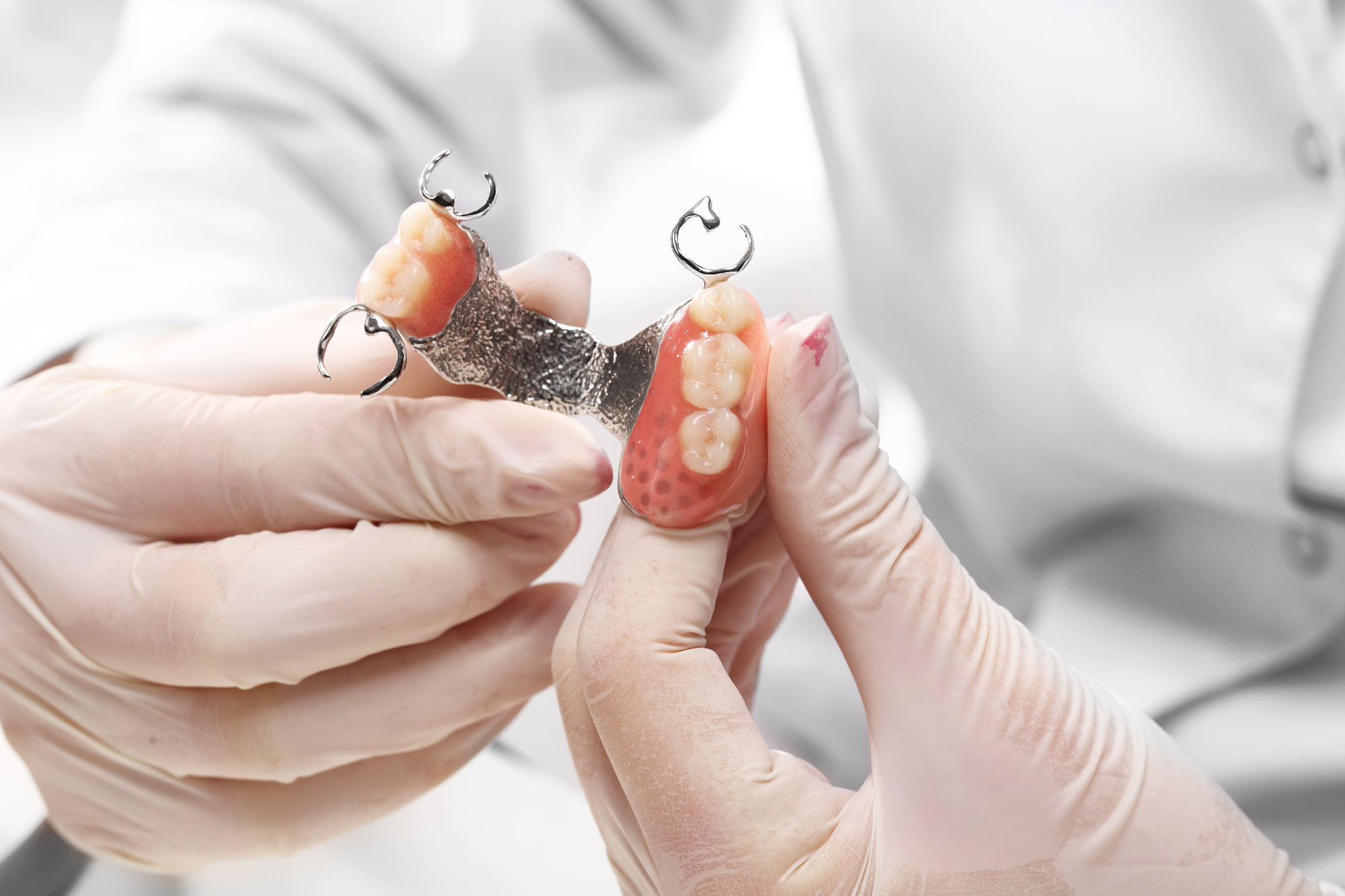 L'importanza dei Ponti Dentali: Come Ripristinare i Tuoi Denti